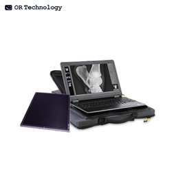 Hệ thống X-Quang kỹ thuật số xách tay - Leonardo DR nano